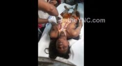 Videos Grotesco de una Autopsia
