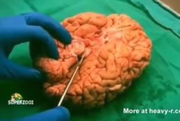 Video Cortando un cerebro humano